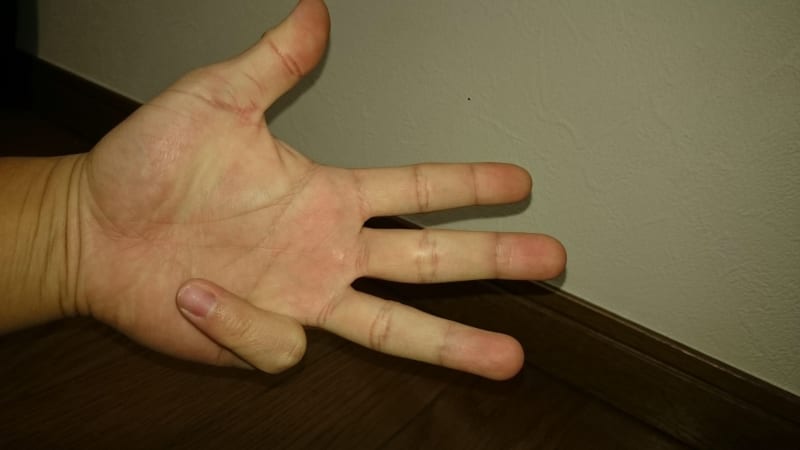 Straight 3rd Finger 朗報 小指を曲げた状態で薬指を伸ばせる人 突然変異の特別な才能だった ストリートロングスケートボーダー Street Long Skate Boarder
