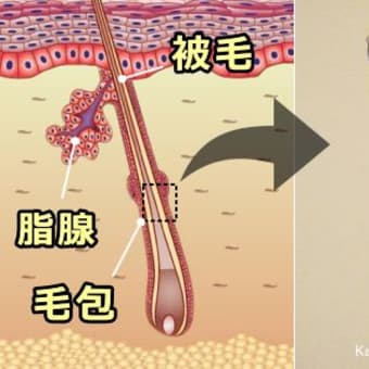 あれってそれってどんなダニなの？　~　顔面ダニ