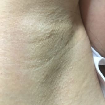 脇が汚い日記1 外見をどうにかしたいブログ
