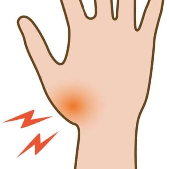 リムパーザ卒業349日目　痛いー😣