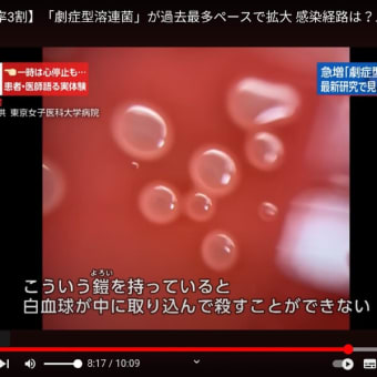 「【致死率3割】「劇症型溶連菌」が過去最多ペースで拡大！」のようだ！・・・以前の日本国内ではほとんど見られなかった疾患だ・・・。