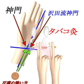 便秘解消にすぐ効くツボを分かりやすく画像にて伝授する！