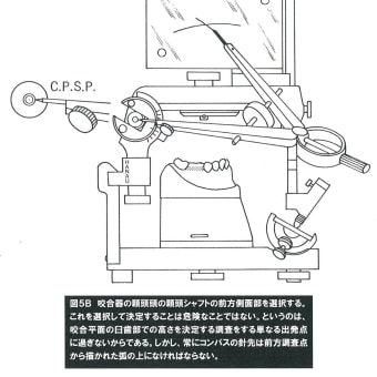 咬合再構築のP-M-Sフィロソフィ教本：抄録ー１９