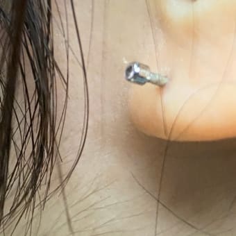ピアッシング３年１か月過ぎ　ついに！？