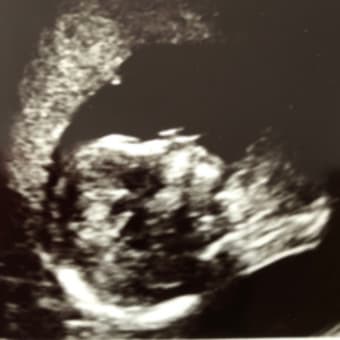 妊婦健診3回目（15w6d）