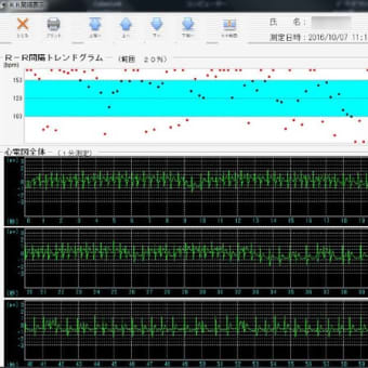 【激レア】　心房細動が収まる瞬間の心電図