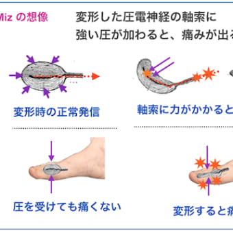 痛みと 圧電神経の関係 ／ Miz のアイディア