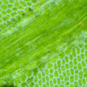 顕微鏡写真：ツルチョウチンゴケの葉の中央の細胞