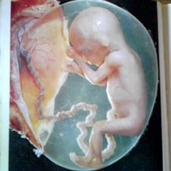 妊娠12週目の赤ちゃん 産むことに迷う人 産みたい人 堕胎 水子供養のこと