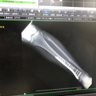 怪我から4ヶ月