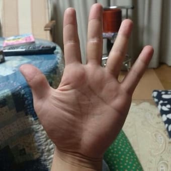 手