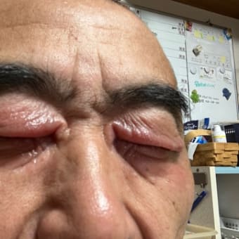 また腫れた