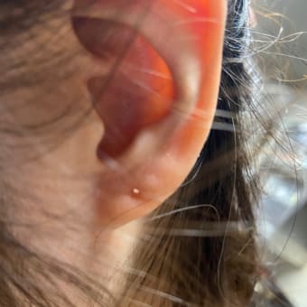ピアッシング３年１か月過ぎ　ついに！？