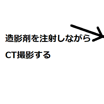 造影剤しながらCT