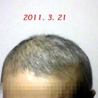 髪型遍歴