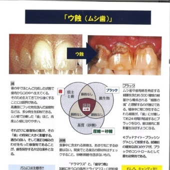健康長寿の薦め：８