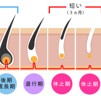 薄毛でお悩みの方に必見！　いま注目の治療法を紹介