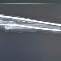 犬の骨折ギプスで治療中！