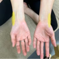 両手が腱鞘炎：福岡から来られた女性ですが、爆発するぐらい喜んでいました（^o^）