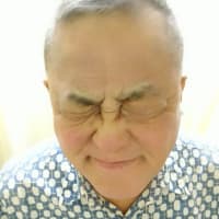 完治症例　重度顔面神経麻痺6０代男性　佐山様