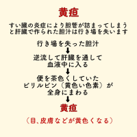 すい臓　要注意　症状