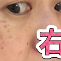 【本当に消えました‼️（追加：比較写真）】
