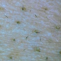 鼻の毛穴について