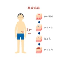 帯状疱疹ワクチンを接種