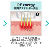 ポテンツァ（POTENZA）とは？
