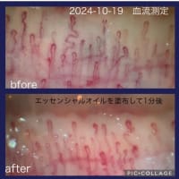 血流測定会を初開催！