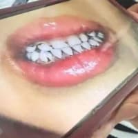 中国の幼稚園で230人超が鉛中毒　現地の鉛汚染の闇に疑惑噴出【動画あり】