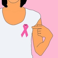乳がん：予防検査の有用性