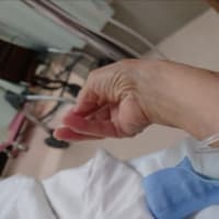 今年15回目の抗がん剤治療,ポート,06/12