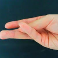 過換気症候群 テタニー の症状 原因 対処方法 パニック障害