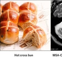 英国の伝統菓子パンhot cross bunと神経疾患