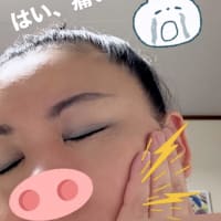 突然の、抜歯…。。。