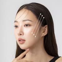 💖 切らずに顔全体が引きあがる！？ オ・スンミン院長の「こめかみ筋膜固定糸リフト」って？