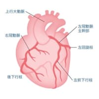 不安定狭心症になり手術しました。