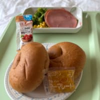 プレート抜去手術