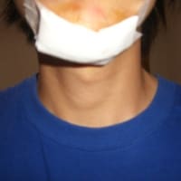 不慮の事故