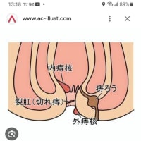 やっと手術