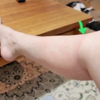退院と検査結果