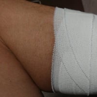 テニスで肉離れ 左足ふくらはぎをやってしまいました いいの何気の部屋