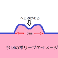 別の医療機関での再検査
