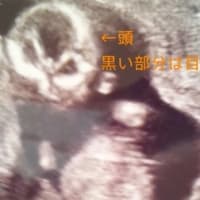 妊娠のジンクス 妊活 妊娠 日々のブログ