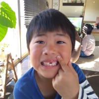 歯ぬけ
