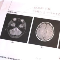 №2041　MRI・・・！