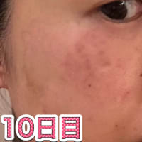【本当に消えました‼️（追加：比較写真）】