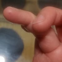 知らないうちに右手薬指の鋭利で深い傷