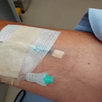 大腸内視鏡検査
